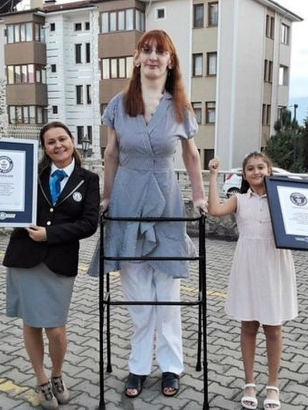 Mulher Mais Alta Do Mundo Altura Guinness Book: Mulher Mais Alta Do