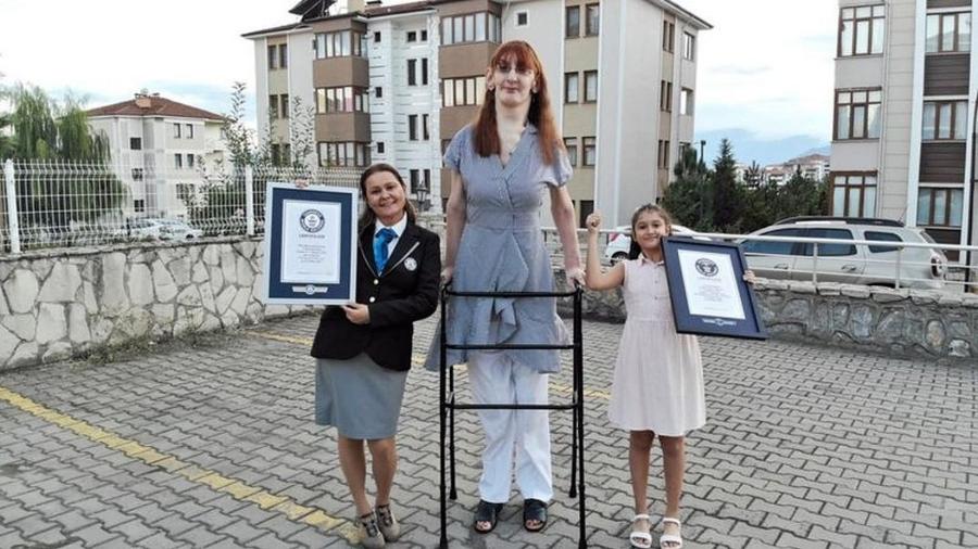 Rumeysa Gelgi tem 2,15 metros de altura e é a mulher mais alta do mundo - Guinness World Records / PA