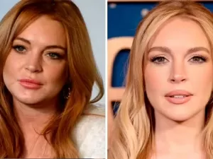 Lindsay Lohan gastou R$ 1,7 milhão para rejuvenescer, diz especialista