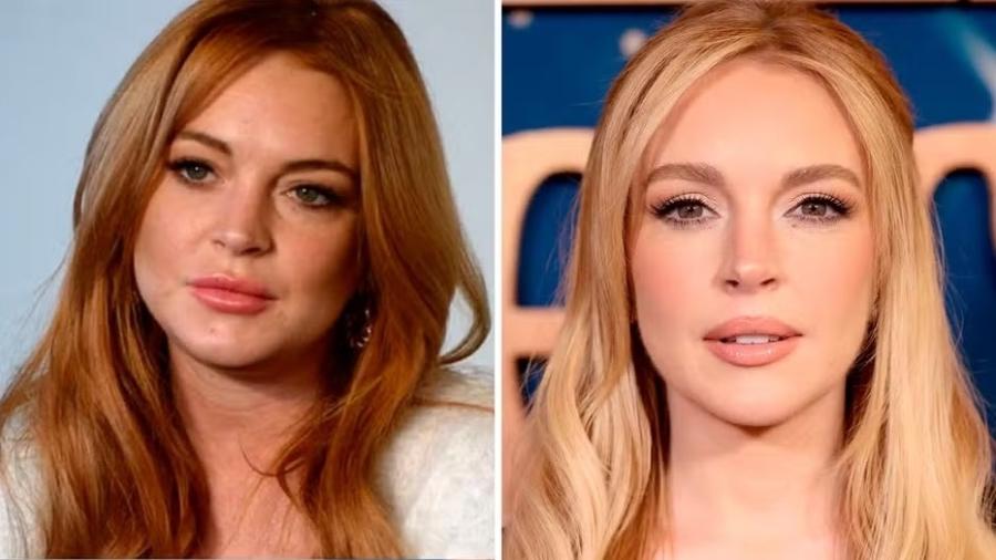 Lindsay Lohan fez procedimentos estéticos