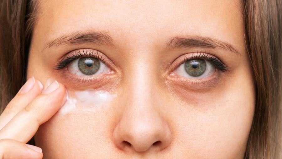 Mulher aplica creme para região dos olhos nas olheiras
