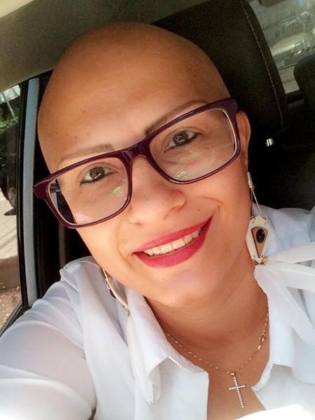 Kelviany Xavier descobriu a alopecia areata aos 14 anos - Arquivo pessoal - Arquivo pessoal