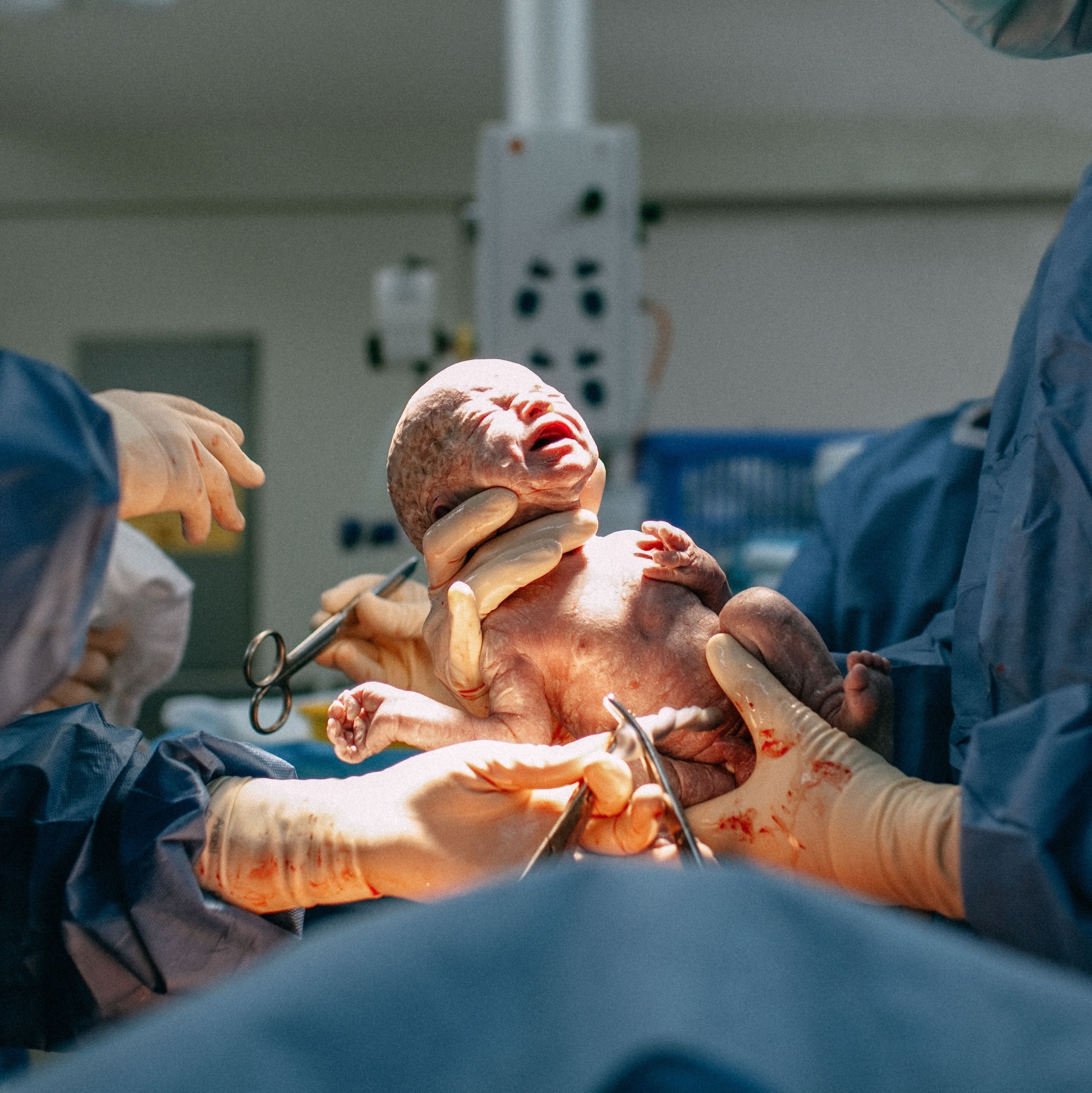 Pós-parto cesárea: Tudo que você precisa saber