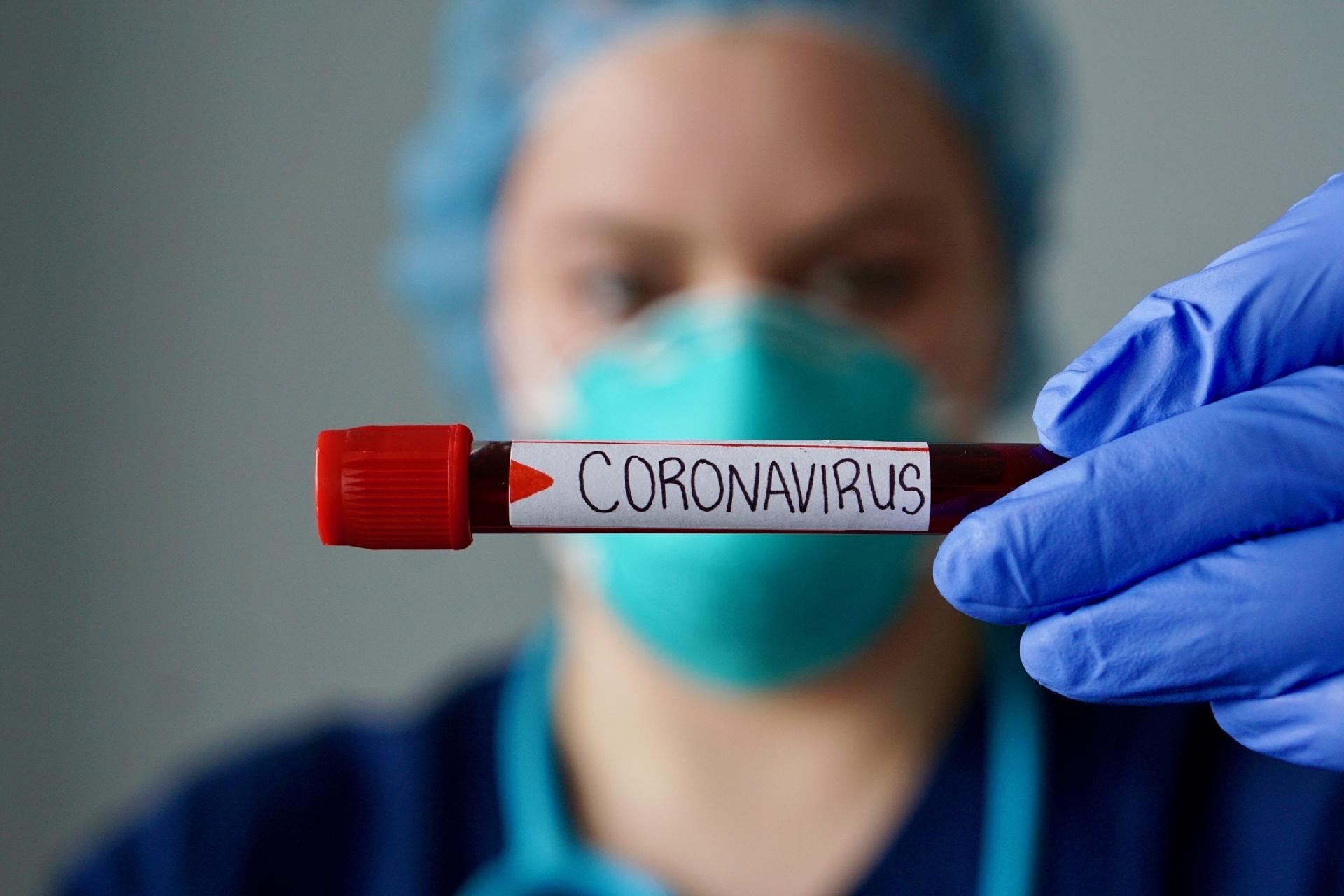 Epidemia de coronavírus já impactou a economia mundial, diz FGV ...