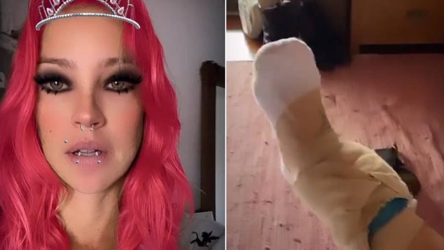 Luana Piovani sofre acidente em passeio com o cachorro - Reprodução/Instagram