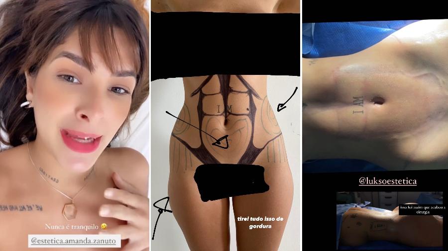 Laryssa Bottino mostrou resultado da lipoaspiração - Reprodução/Instagram