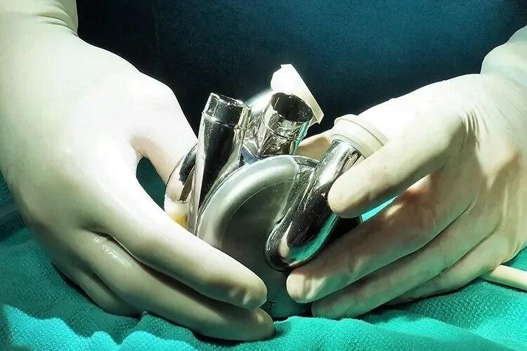 O pequeno coração de titânio, que cabe até no peito de uma criança de 12 anos O pequeno coração de titânio, que cabe até no peito de uma criança de 12 anos