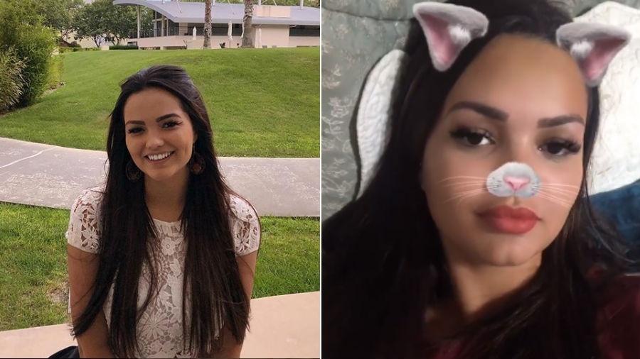 Antes e depois de Suzanna Freitas fazer procedimentos na boca e na sobrancelha - Reprodução/Instagram