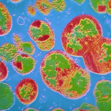 A gonorreia é causada pela bacteria Neisseria - CNRI/SCIENCE PHOTO LIBRARY