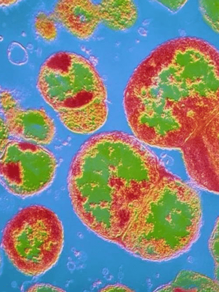 A gonorreia é causada pela bacteria Neisseria - CNRI/SCIENCE PHOTO LIBRARY
