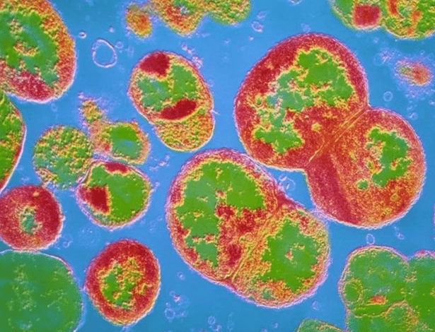 A gonorreia causada por uma bactéria - CNRI/SCIENCE PHOTO LIBRARY