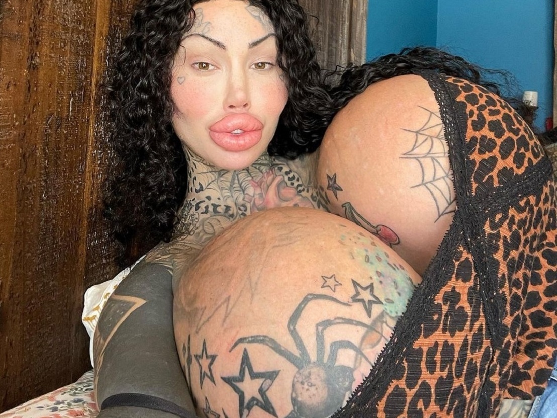 OnlyFans: Modelo precisa de cadeira de rodas pelo tamanho dos seios