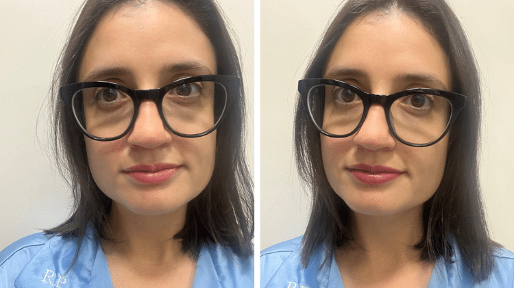 Antes e depois da primeira aplicação do batom da Make B., feita antes de dormir Antes e depois da primeira aplicação do batom da Make B., feita antes de dormir