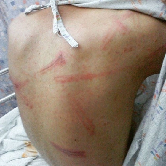 "Fui torturado muitas vezes por causa da minha sexualidade. Ser gay me fez ser espancado por membros da minha", Mohamed, do Golfo Pérsico, no Oriente Médio. - Robin Hammond