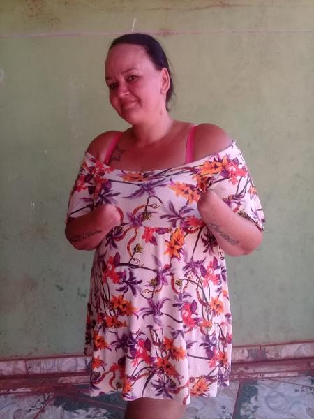 A ex-diarista Geziane Buriola da Silva sofreu tentativa de feminicídio - Arquivo Pessoal