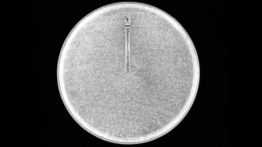 Em teste de resistência, fungo da espécie Candida parapsilosis foi cultivado no centro da placa com fluconazol, uma das principais classes de antifúngicos. Quando passa de 8 miligramas por litro (mg/l) na escala localizada ao centro, o fungo é considerado resistente. Na amostra, a concentração ultrapassou 256 mg/l - Acervo dos pesquisadores/Fapesp