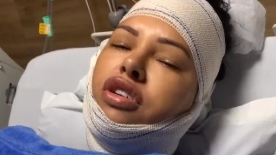 Ariadna Arantes mostra vídeo de pós-operatório - Reprodução/Instagram