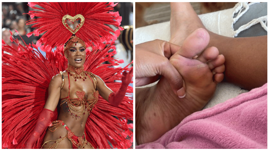 MC Rebecca mostrou machucados na sola dos pés após o Carnaval - Lucas Landau/ UOL e Reprodução / Instagram