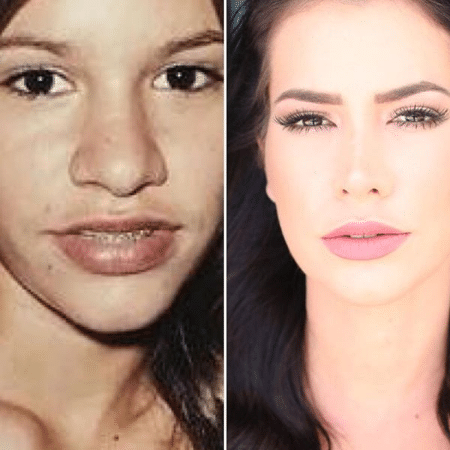 Adriana Sant"Anna antes e depois de fazer rinoplastias - Reprodução/Instagram