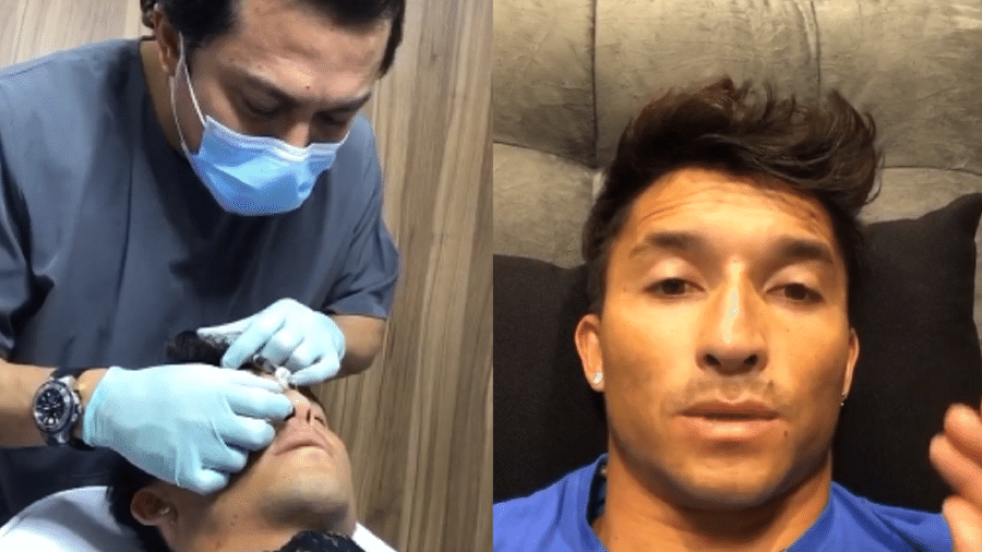 Flávio Nakagima faz intervenção estética no nariz - Reprodução/Instagram