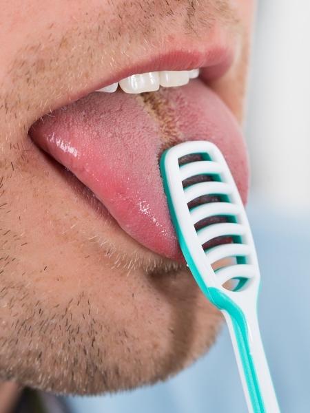 Falta de higiene bucal é uma das causas da língua pilosa (foto ilustrativa, no fim da notícia reproduzimos a imagem da língua do paciente indiano, que pode ser muito desagradável para algumas pessoas) - iStock
