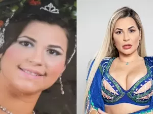 Harmonizou, preencheu, remodelou: o antes e depois de Deolane Bezerra