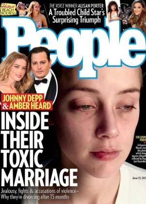 "People" divulga capa com nova foto da atrz Amber Heard machucada - Divulgação/People