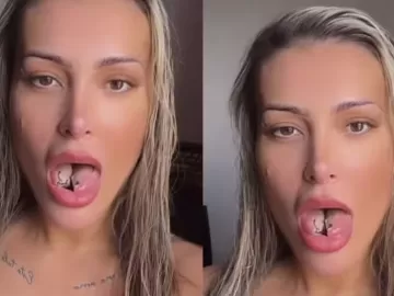 Após bifurcação da língua, Andressa Urach mostra recuperação: 'Dor menor'