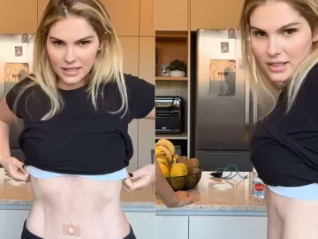 Bárbara Evans mostra resultado de cirurgias plásticas