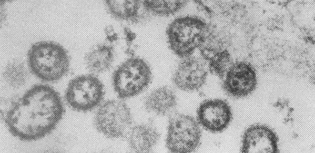 Ministério confirma morte | Como cientistas descobriram novo vírus que causa febre hemorrágica no país
