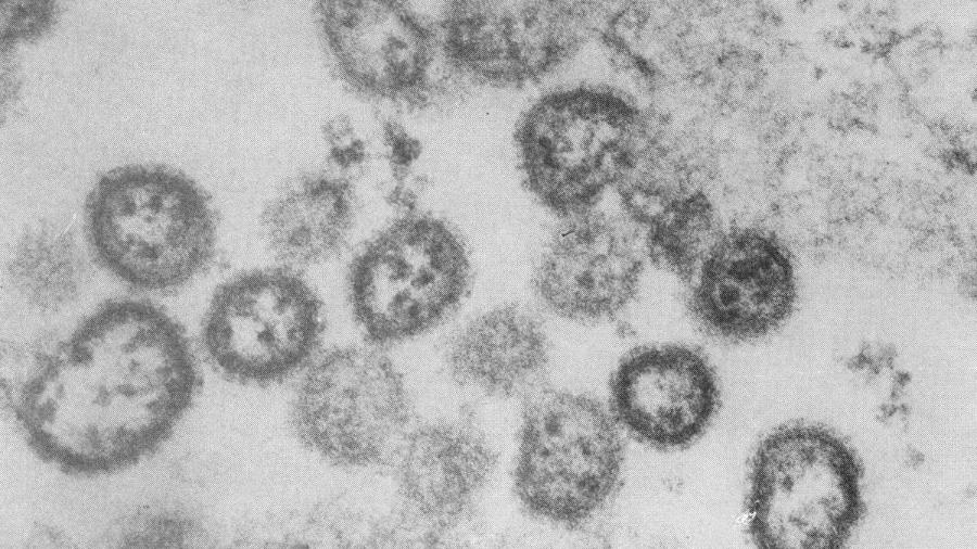 Arenavírus detectado em Serra Leoa, na África, aparentado do encontrado em Sorocaba (SP) - Bulletin of the World Health Organization