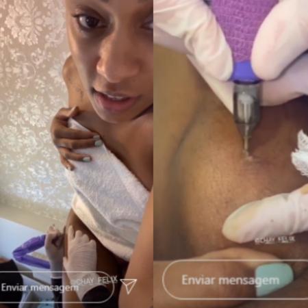 MC Rebecca, em clínica estética, se submete a sessão de "tatuagem reparadora estética" - Reprodução/Instagram