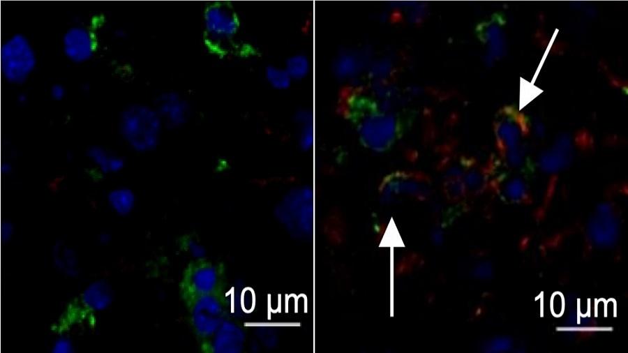  À esquerda, em azul, núcleo da célula de fígado de camundongo saudável; à direita, órgão de animal infectado por vírus da hepatite murina com setas apontando expressão da proteína TMEM176D, em vermelho - Maite D. Veja et. al./Fapesp