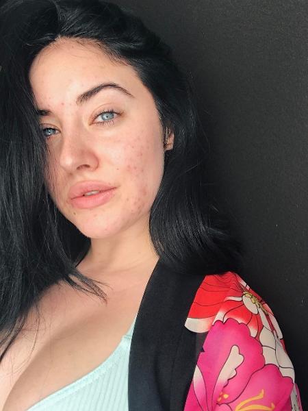 A modelo e cantora Starlie Smith, que costuma mostrar sua pele natural nas redes sociais. - Reprodução/Instagram