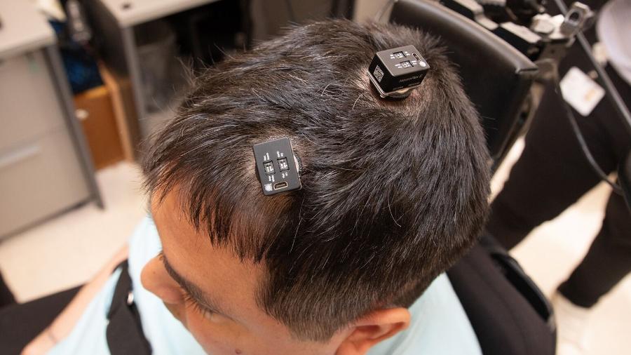 Implante cerebral faz tetraplégico sentir objeto usando mão de outros