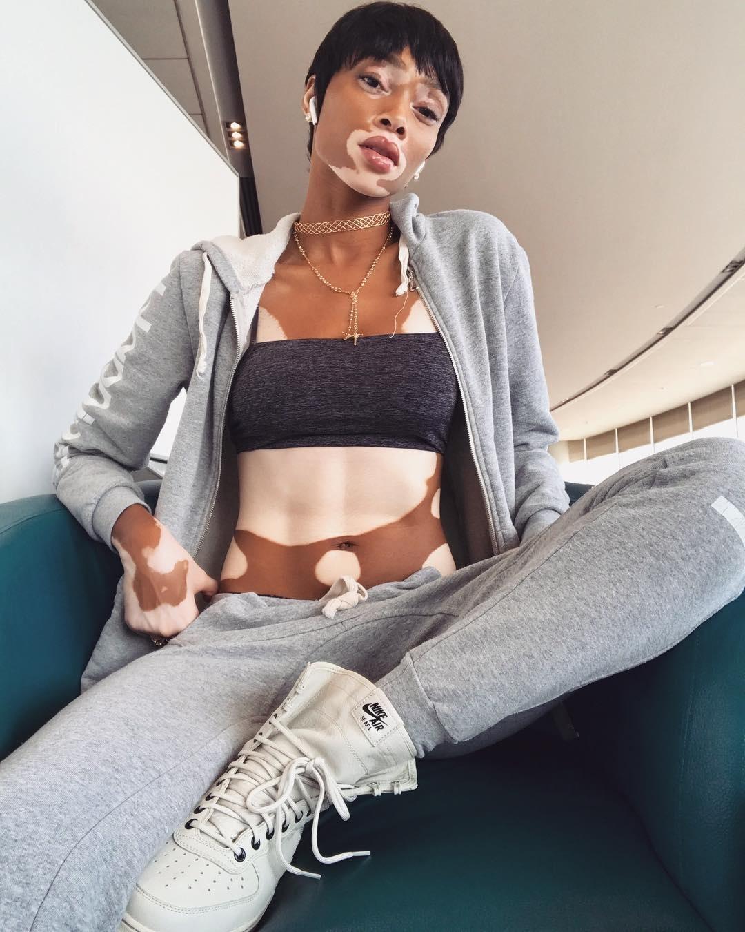 A top Winnie Harlow é fã da versão esportiva da calça - Reprodução/Instagram/@winnieharlow