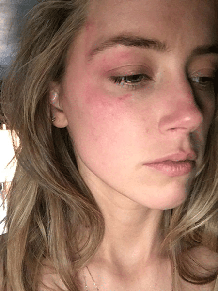 A atriz Amber Heard alega que foi agredida por Johnny Depp - Reprodução - Reprodução