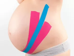 Entenda como taping ajuda a melhorar a recuperação no pós-parto 