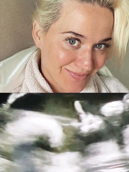 Katy Perry e ultrassom - REPRODUÇÃO/INSTAGRAM