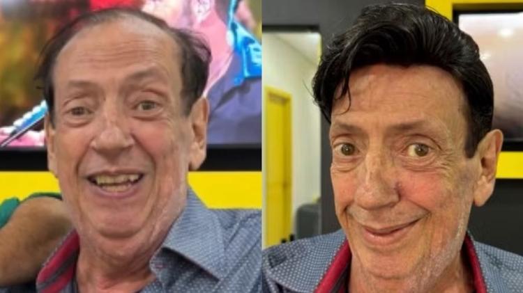 Marcos Oliveira mostra antes e depois de visual Marcos Oliveira mostra antes e depois de visual