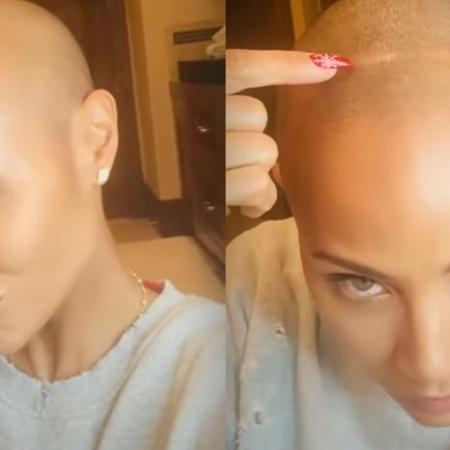 A calvície de Jada Pinkett Smith é causada pela alopecia, uma doença autoimune - Reprodução/Instagram 