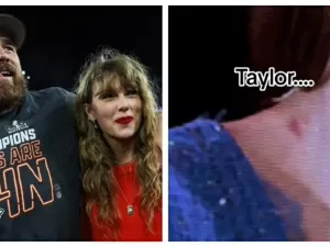 Taylor Swift chama atenção dos fãs por 'chupão' no pescoço em show; veja
