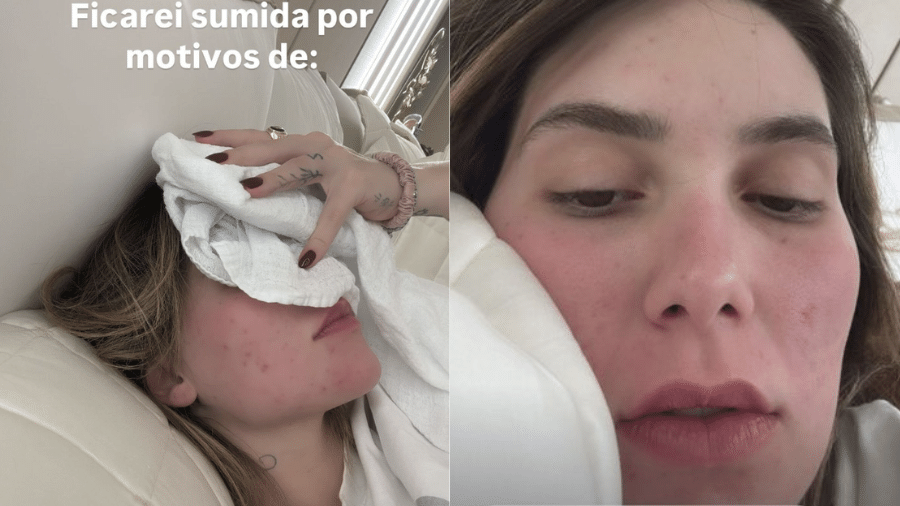 Virginia Fonseca fica longe das redes devido a enxaqueca - Instagram