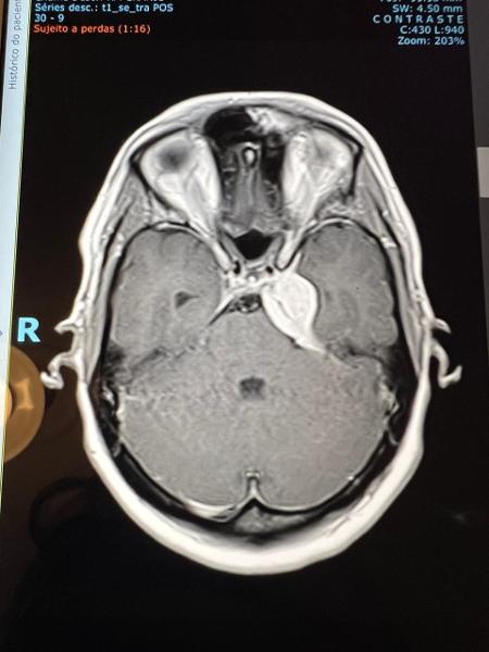 Resultado do exame que mostrou o tumor de Luiza Resultado do exame que mostrou o tumor de Luiza