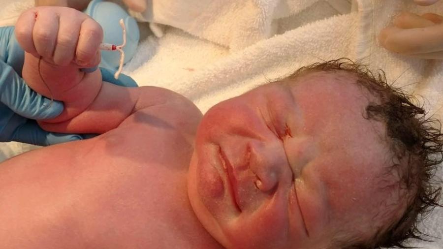O bebê Dexter Tyler, em foto onde segura o DIU que a mãe dele usava para evitar uma gravidez - Reprodução/Facebook