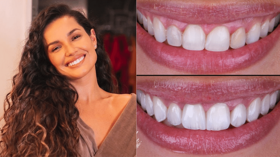 Juliette Freire colocou lente de contato nos dentes - Reprodução/Instagram