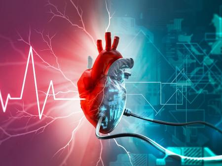 Dispositivo de assistência ventricular é diferente de marca-passo, mas também ajuda pacientes cardíacos - iStock
