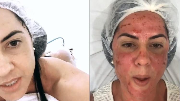 Graciele Lacerda exibe seus tratamentos estéticos para seguidores - Reprodução / Instagram - Reprodução / Instagram