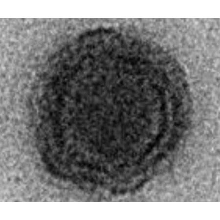 Negativo da imagem do novo Yaravirus - Boratto et al., 2020, bioRxiv