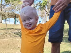 'Carro tem proteção UV': mãe fala de albinismo parcial do filho; o que é?